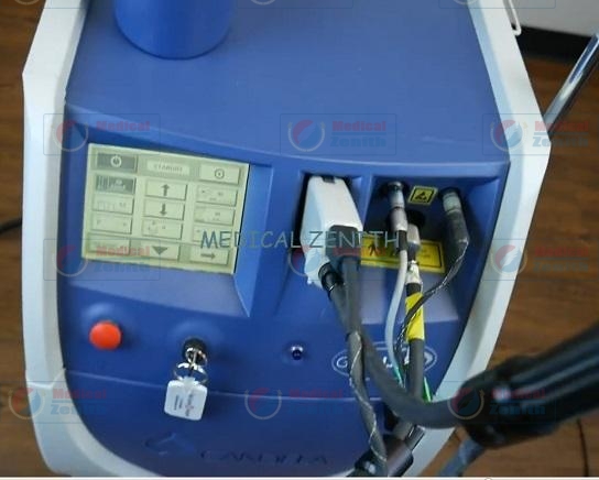 The Candela GentleLase | GentleLASE Hair Removal Laser