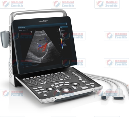 mindray z60 ultrasound